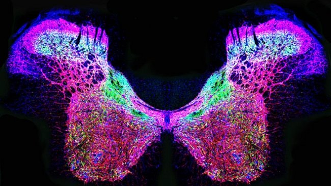 Zářivé zelené pavučiny a růžoví motýli - to jsou vítězné snímky soutěže Bio-Art