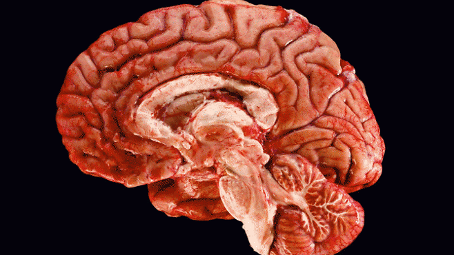 Tajemný mozek