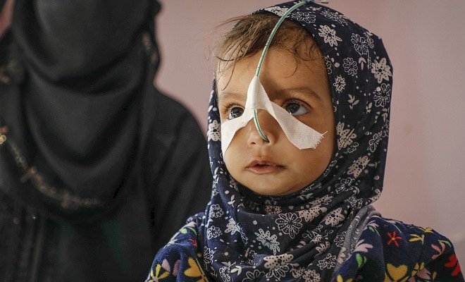 Malá Giham z Jemenu statečně bojuje o život již od narození
