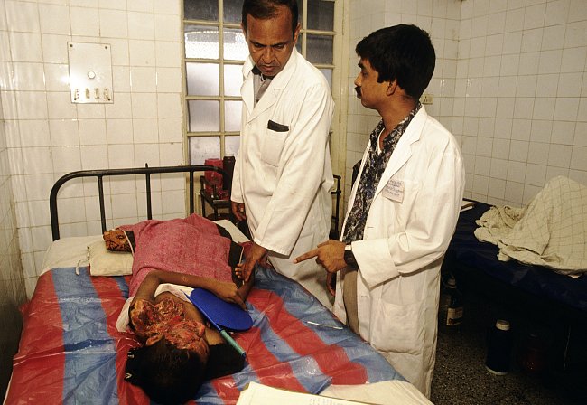 Bangladéš se 120 milony obyvatel má jen čtyři chirurgy specializující se na plastické operace.