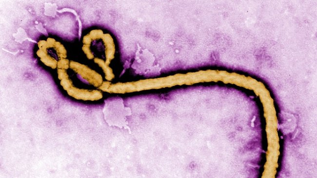 Epidemie Eboly se na západě Afriky vymyká kontrole