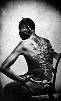 Bičovaný otrok