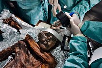 Neurochirurgové provádějí v roce 2011 pitvu pět tisíc let staré neolitické mumie, aby zjistili její genetický kód a příčinu smrti. Člověk doby ledové byl nalezen v Alpách na hranici Rakouska a Itálie v roce 1991.