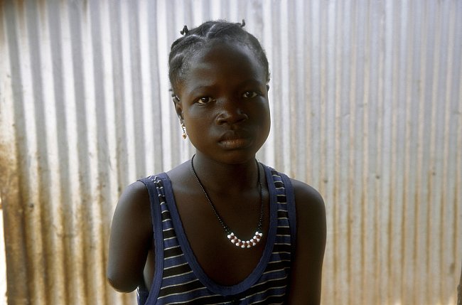 V Sierra Leone žijí tisíce amputees - lidí, kterým povstalci uťali ruce nebo nohy. 