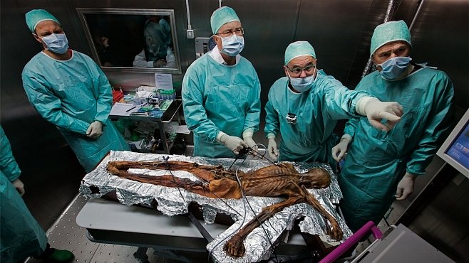 Nejstarší lidská krev světa pochází z ledového muže Ötziho