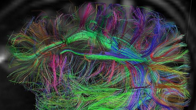 Země neznámá i fantastická: Mapa lidského mozku připomíná sen