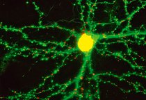 ZÁBLESK VZPOMÍNKY Při vzniku vzpomínky „nastává v mozku fyzická změna“, říká Donald Arnold z University of Southern California. Červené a zelené body na jednotlivých výběžcích neuronu potkana ukazují,