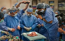 Chirurgové na klinice v Clevelandu v Ohiu odňali během 16hodinové operace obličej dárkyně. Dalších 15 hodin přišívali obličej pacientce Katie Stubblefieldové.