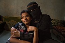 Matka láskyplně objímá Salíma al-Harázího, kterému ostřelovač vystřelil obě oči. Dvanáctiletý chlapec byl postřelen, když se v březnu 2011 připojil k protivládním demonstrantům v San‘á.