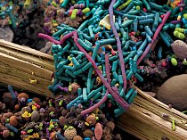 Lidská střeva se přímo hemží bakteriemi, z nichž mnohé druhy jsou dosud neznámé. Pomáhají nám trávit potravu a vstřebávat živiny a mají jistou úlohu při ochraně střevních stěn. 