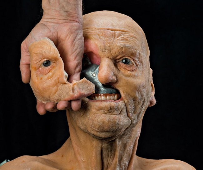 (nahoře vpravo). Model ukazuje titanový plát pod tváří pacienta, který následkem rakoviny přišel o lícní kost, horní čelist a pravé oko (dole). Technici vytvořili na 3D tiskárně implantát s využitím digitálních skenů zdravé strany tváře.