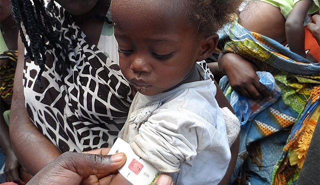 Česká pomoc zachraňuje desetitisíce afrických dětí před hladem