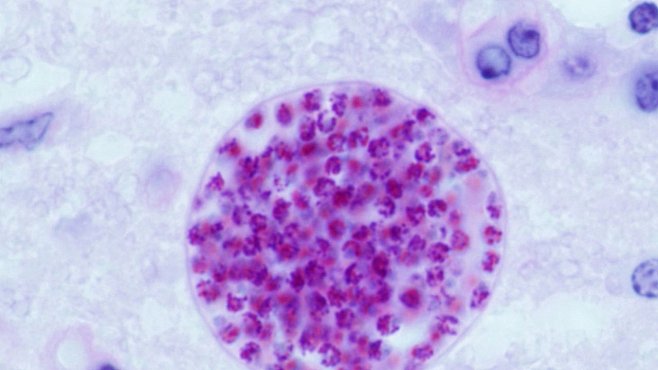 ROZHOVOR: Toxoplazma dokáže změnit lidské chování. Můžete se nakazit od koček