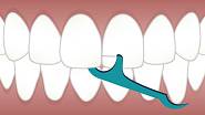 Čištění zubů zubní nití