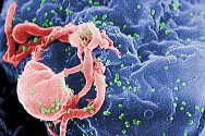 Lymfocyt napadený zelenými částečky viru HIV. Snímek z elektronového mikroskopu je dobarven.