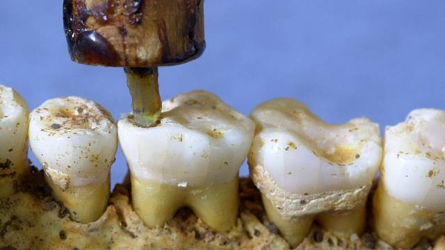 Rekonstrukce vrtání zubu pravěkým nástrojem