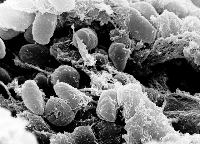 Bakterie Yersinia pestis.