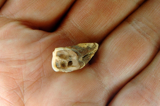 Jeden z vyvrtaných zubů nalezený v Pákistánu