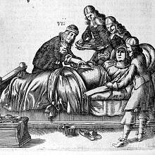 První císařský řez, který přežila matka i dítě, byl proveden v Praze roku 1337