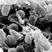 Původce moru bakterie Yersinia pestis pod elektronovým mikroskopem.
