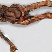 Tělo Ötziho