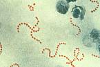 Bakterie Streptococcus pyogenes, která způsobuje horečku omladnic