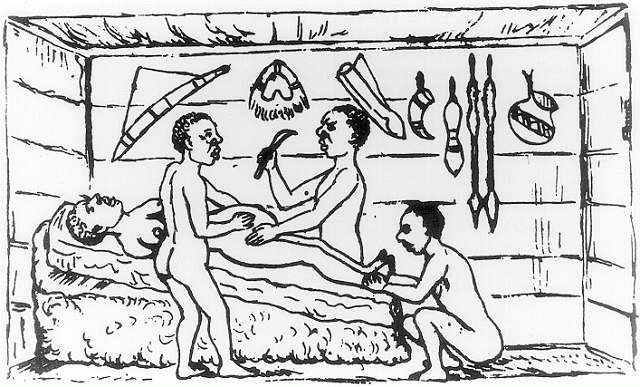 Císařský řez prováděný v Ugandě 1879