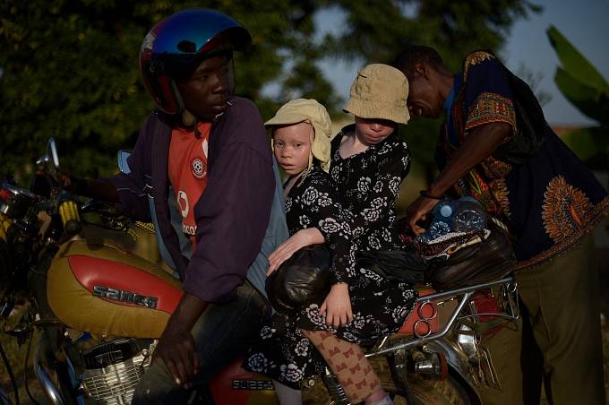 Situace se postupně zlepšuje, vláda se snaží albíny zapojit do normálního života.