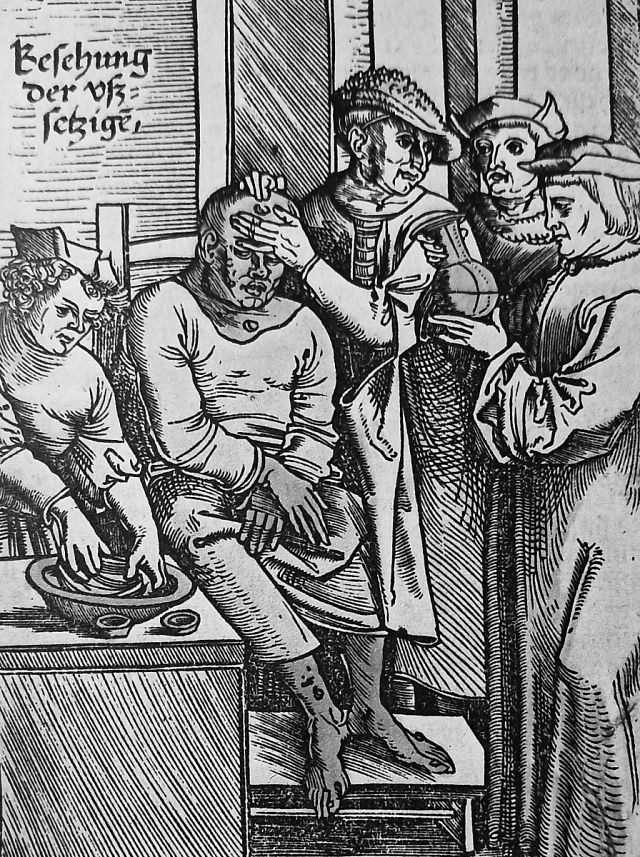 Diagnostikování lepry ve středověku