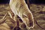 Dýmějový mor způsobuje bakterie Yersinia pestis