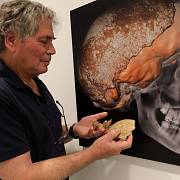 Izraelští vědci ukazují fosilní fragmenty lebky a čelisti na univerzitě v Tel Avivu v Izraeli 27. června 2021. Pozůstatky se skládaly z kostí patřících "novému typu raného člověka".