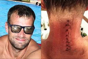 Michal Šámal se těžce zranil po skoku do mělkého bazénu na dovolené v Tunisku