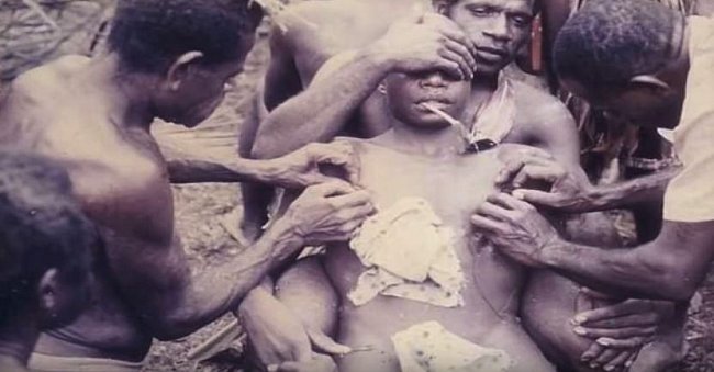 Tento kmen Aboridžinců byl obzvlášť krutý. Mladým mužům byla na několika místech naříznuta kůže a provedena také obřízka. Nešťastníci pak byli ponecháni bez ošetření v bolestech.