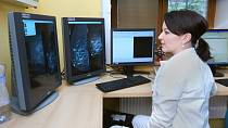 Mamograf, nebo ultrazvuk?