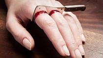 Nejděsivnější tresty, které mohla žena dostat za zapovězenou lásku - ilustrační foto - useknutí prstů