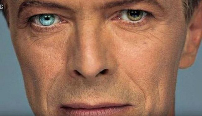 David Bowie měl jedno oko výrazně jiné barvy než to druhé