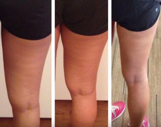 Похудение в ногах до и после фото