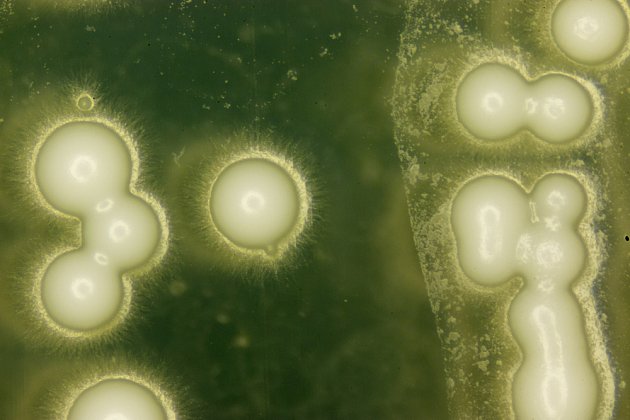 Kvasinky pod mikroskopem