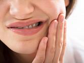 Pokud nás k zubaři přivede až silná bolest zubů, je většinou už hodně pozdě.