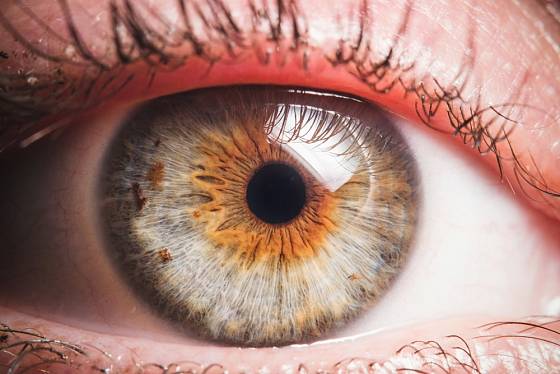 Oční duhovka mívá různé zbarvení.