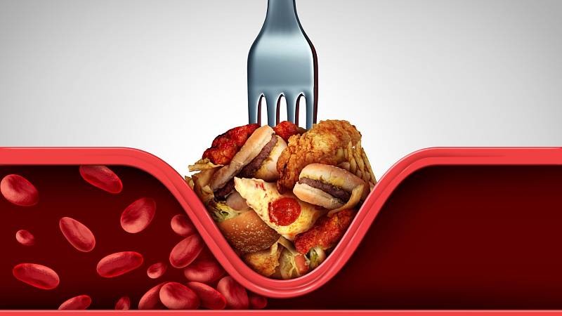 Pohlídejte si hladinu cholesterolu. Zjistěte, kdy je třeba navštívit lékaře