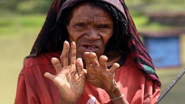 Zvláštností kmene je sekání ženských prstů