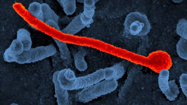 Obarvený virus eboly, jeden z pěti kmenů.