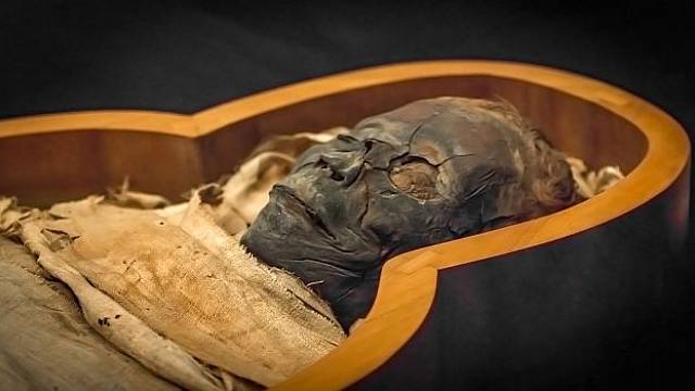 Staré Egypťany trápila celá řada nemocí