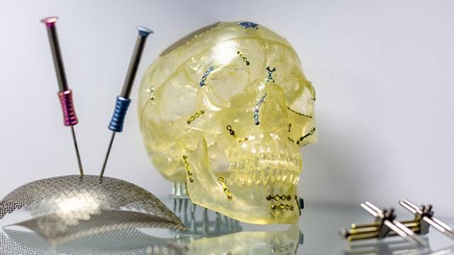 Díky moderní vědě lze rekonstruovat tváře dávno zemřelých lidí