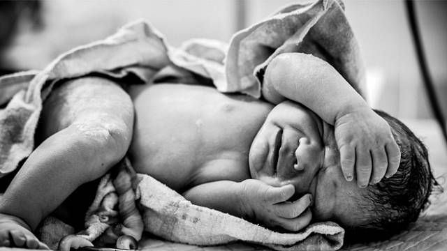 Porod císařským řezem byl ještě donedávna rizikovým zákrokem