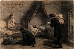 Kresba A. Gautiera z roku 1859 zachycuje nemocného cholerou.