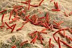 Bakterie Mycobacterium leprae způsobující lepru