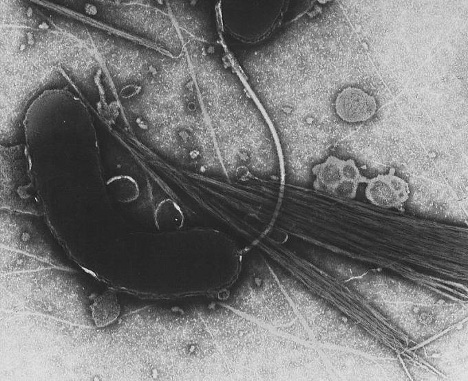 Bakterie Vibrio cholerae