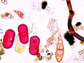 Pohled mikroskopem na pyl Miříkovitých a plíseň Alternaria..
